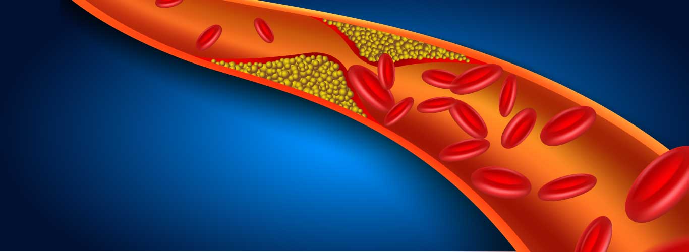 Aortic-Aneurysm-Symptoms-Causes-and-Diagnosis