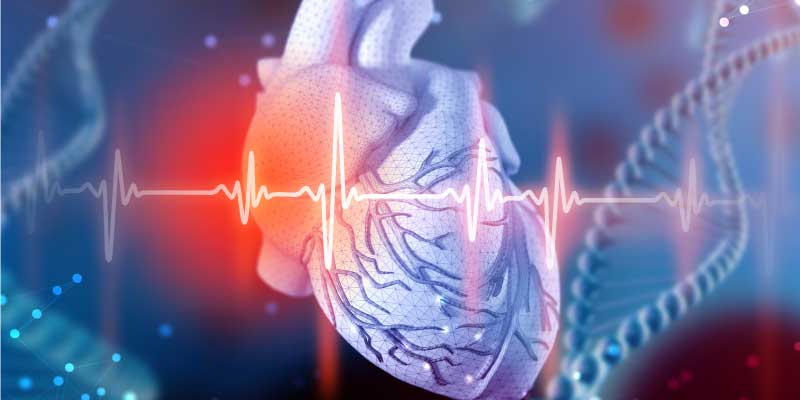 Causes-of-Arrhythmia