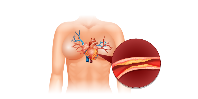 Causes-of-Heart-Failure-1